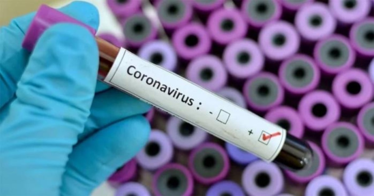 В Украине зарегистрирован первый случай заражения коронавирусом