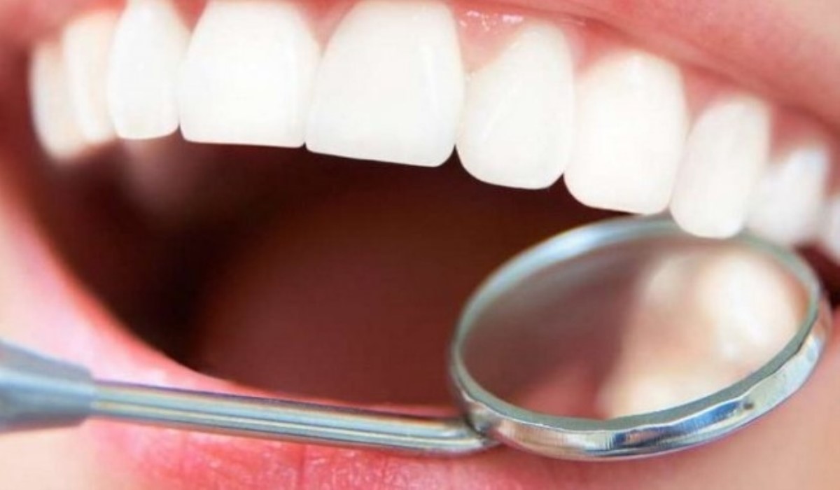 Самые нелепые мифы о здоровых зубах