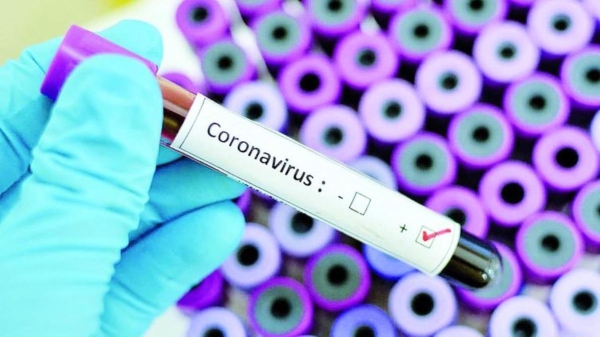 Откуда взялся COVID-19: врач рассказала о происхождении коронавируса