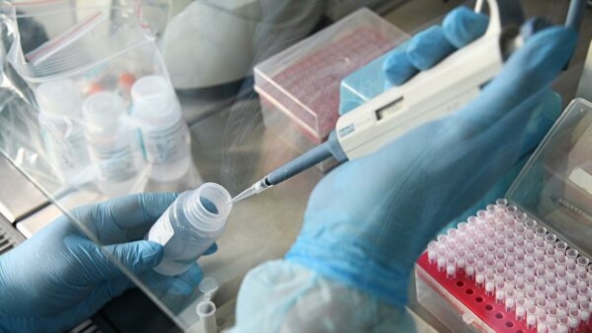Тест-системы коронавируса готовы! Украинские ученые совершили прорыв