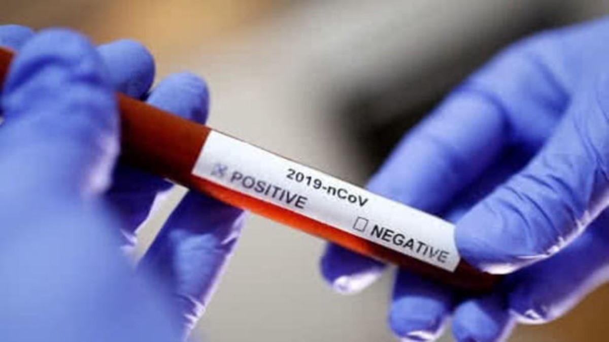 Почему массово врут тесты на коронавирус