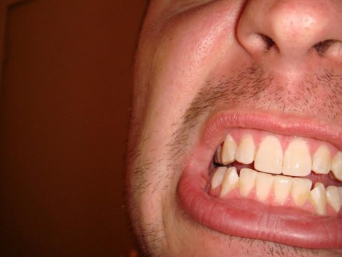 Этот метод лучше всего помогает от зубной боли