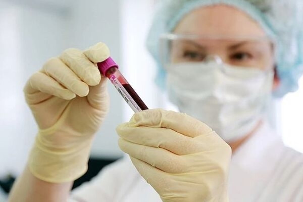 Почему ПЦР-тесты на коронавирус ошибаются: мнение биолога