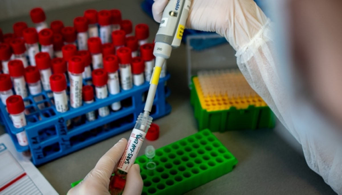 Количество зараженных коронавирусом украинцев продолжает увеличиваться