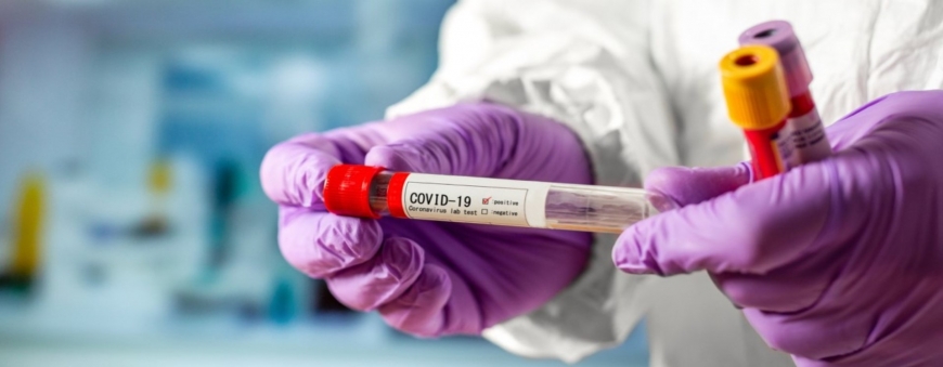 Украинцев будут массово проверять на коронавирус