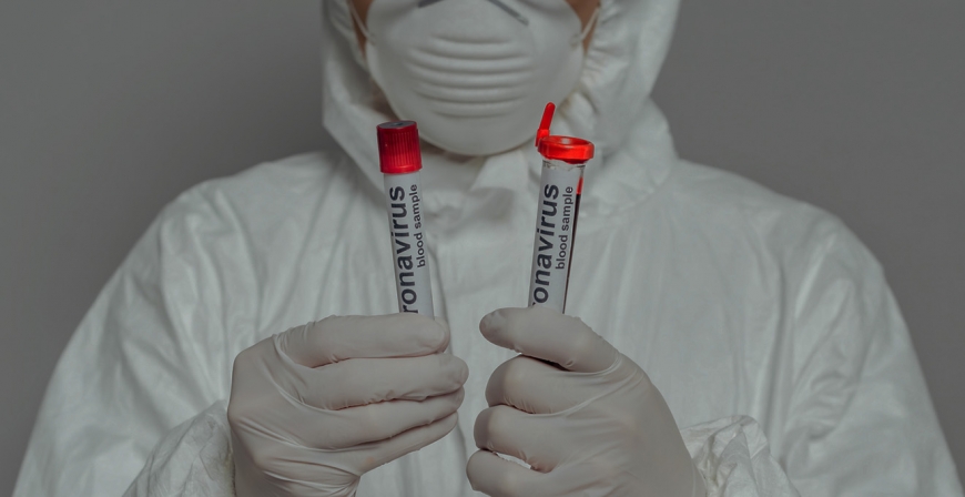 Ученые назвали сроки заразности больного с коронавирусом