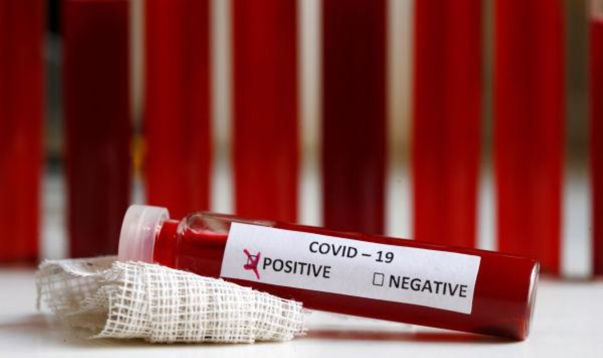 Статистика по COVID-19 в мире резко ухудшилась