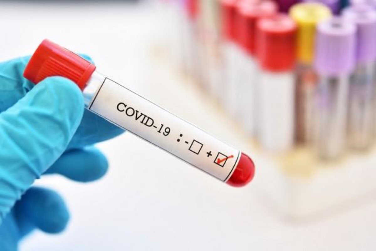 Количество новых зараженных COVID-19 в Украине практически не меняется уже несколько дней