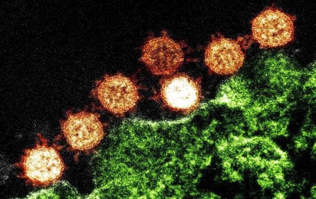 Ученые приоткрыли некоторые тайны коронавируса