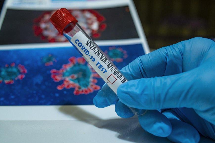 Ученые назвали распространенные пути передачи коронавируса