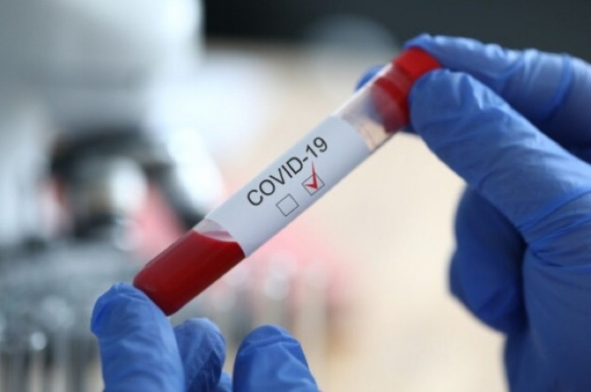 Медики не смогли обнаружить подтверждений сезонности коронавируса