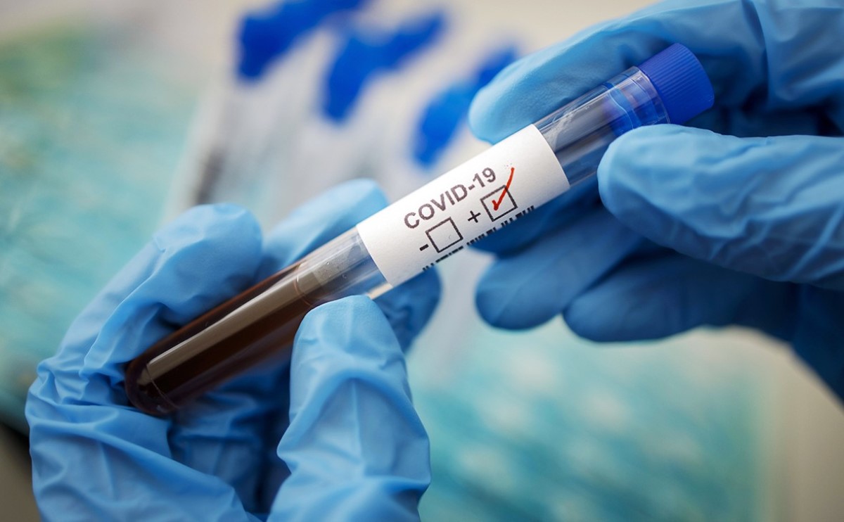 В Украине резко выросло число больных COVID-19