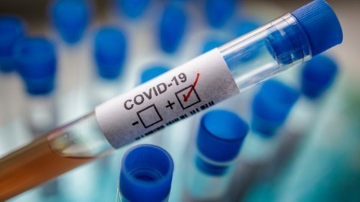 В Одессе от осложнений COVID-19 умерла туристка