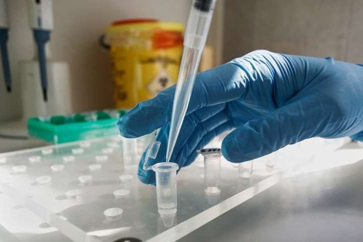 В Украине проведено рекордное количество ПЦР-тестов на коронавирус