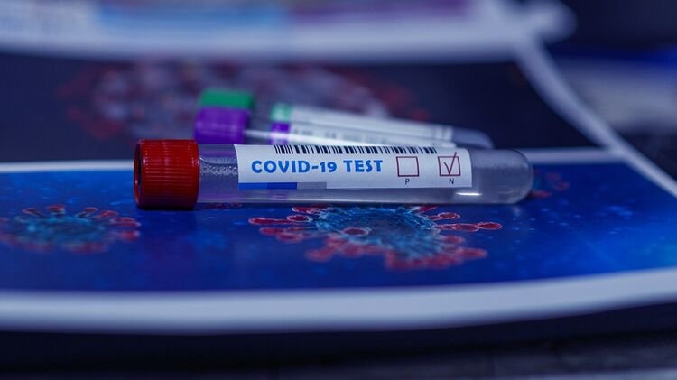 В Украине начали торговать справками об отрицательном ПЦР-тесте на коронавирус