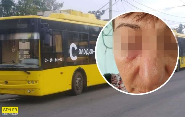В Сумах пассажир из-за маски покалечила кондуктора: детали ЧП