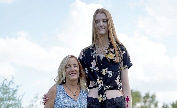 Жительница США обогнала рекорд Катерины Лисиной по длине ног