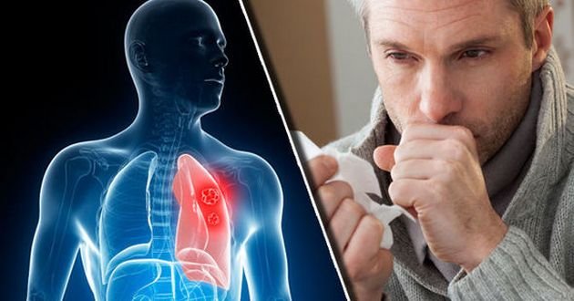 Врачи предупреждают: сдерживать кашель и чихание опасно