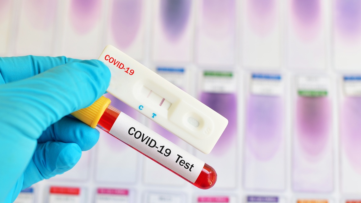 В Киеве увеличат количество COVID-тестирований
