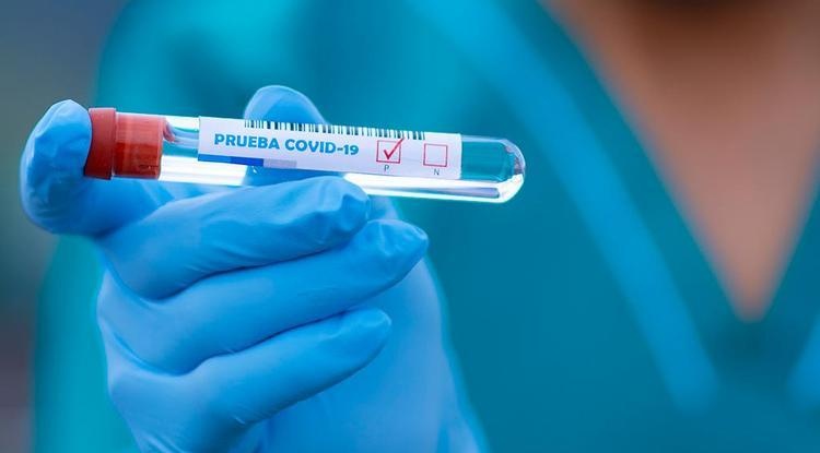 Большинство украинских лабораторий используют в ПЦР-тестах на коронавирус дешевые реагенты