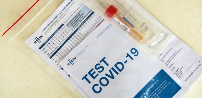 Сначала справка – потом собеседование: украинские работодатели стали требовать тесты на COVID-19