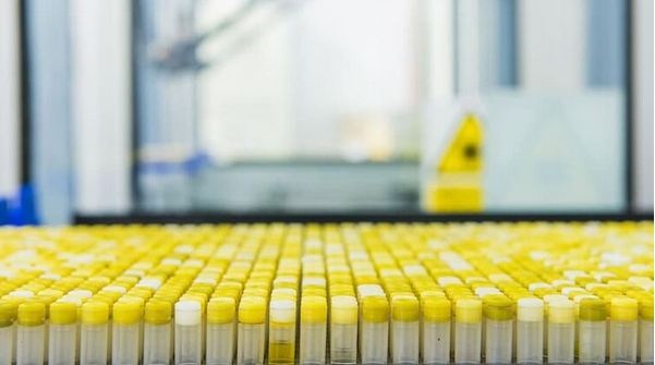 Украинцев к вакцинации от COVID будут готовить: какие этапы и сроки