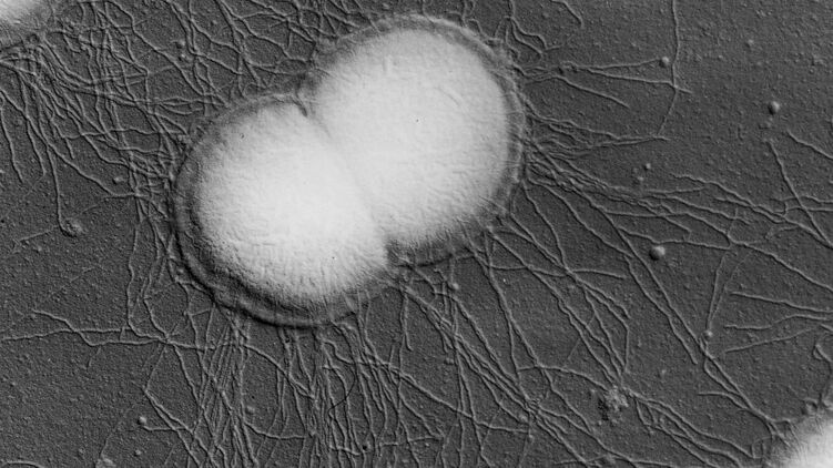 После пандемии коронавируса человечеству грозит неизлечимая гонорея - ВОЗ