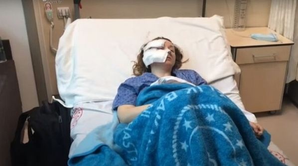 Ревнивый турок изрезал лицо жены-украинки: подробности