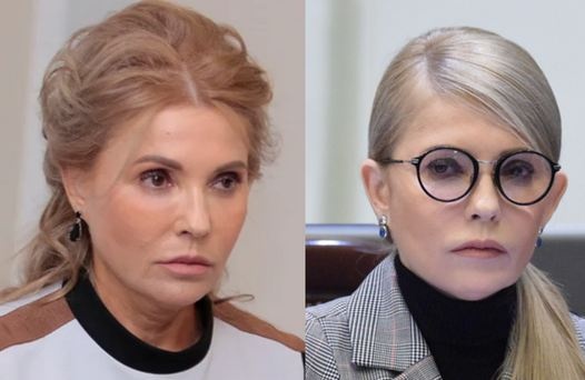 Как "кроили" лицо Юлии Тимошенко: косметолог объяснила суть операции