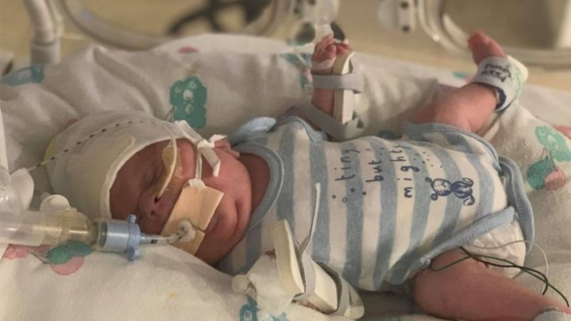 Весил менее 800 грамм: новорожденный чудом выжил после коронавируса