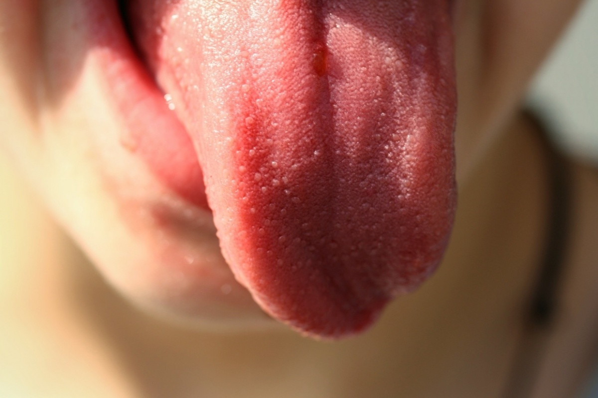 "Ковидный язык": эпидемиолог показал, как выглядит новый симптом болезни