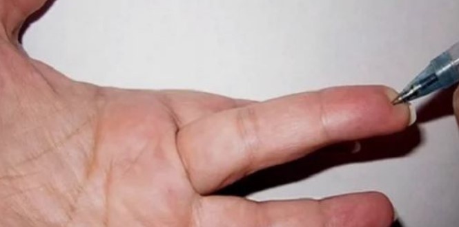 Военные используют эту точку на пальце, чтобы снизить боль