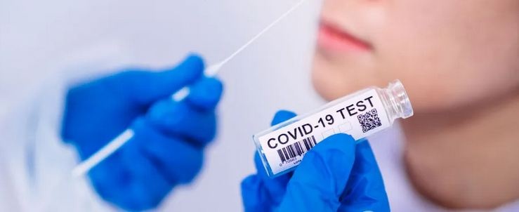 Тест на Covid-19 при отсутствии симптомов: в Минздраве дали объяснение