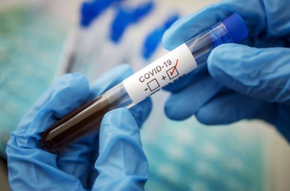Инфекционист назвал возможную причину вспышки COVID в Прикарпатье