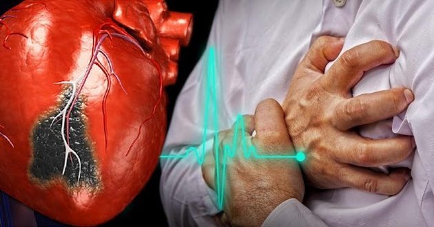 Боль в пальце и потеря сознания: названы нетипичные симптомы инфаркта