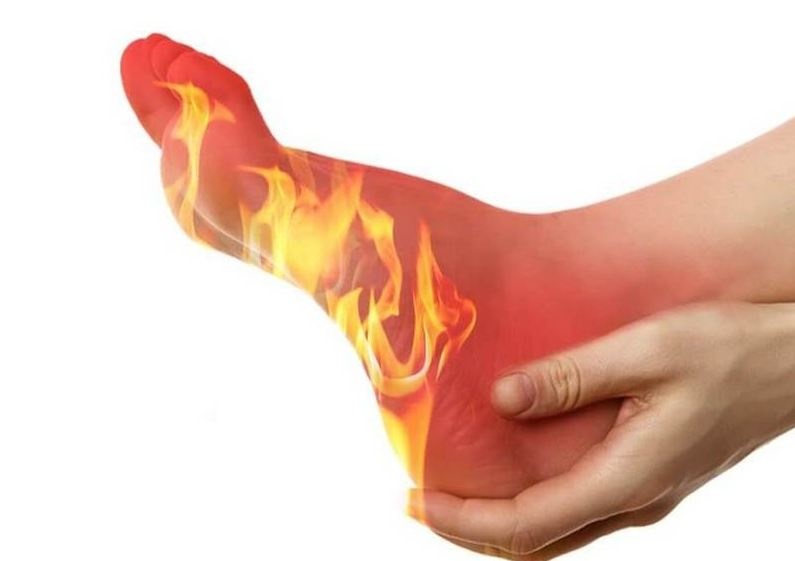 Почему "горят" ступни: врачи объяснили причины жжения в ногах