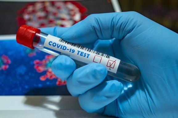 В Украине снизилось количество заразившихся коронавирусом