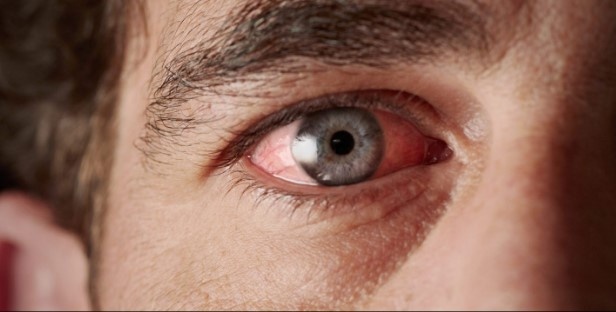 Лекарственные препараты, способные вызвать синдром сухого глаза