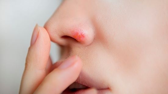 Боль в носу: медики перечислили заболевания