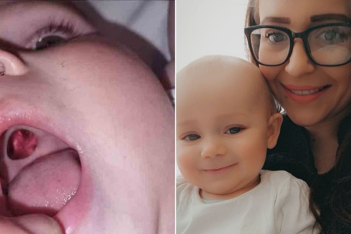 Молодая мама обнаружила во рту 10-месячного сына "дыру"