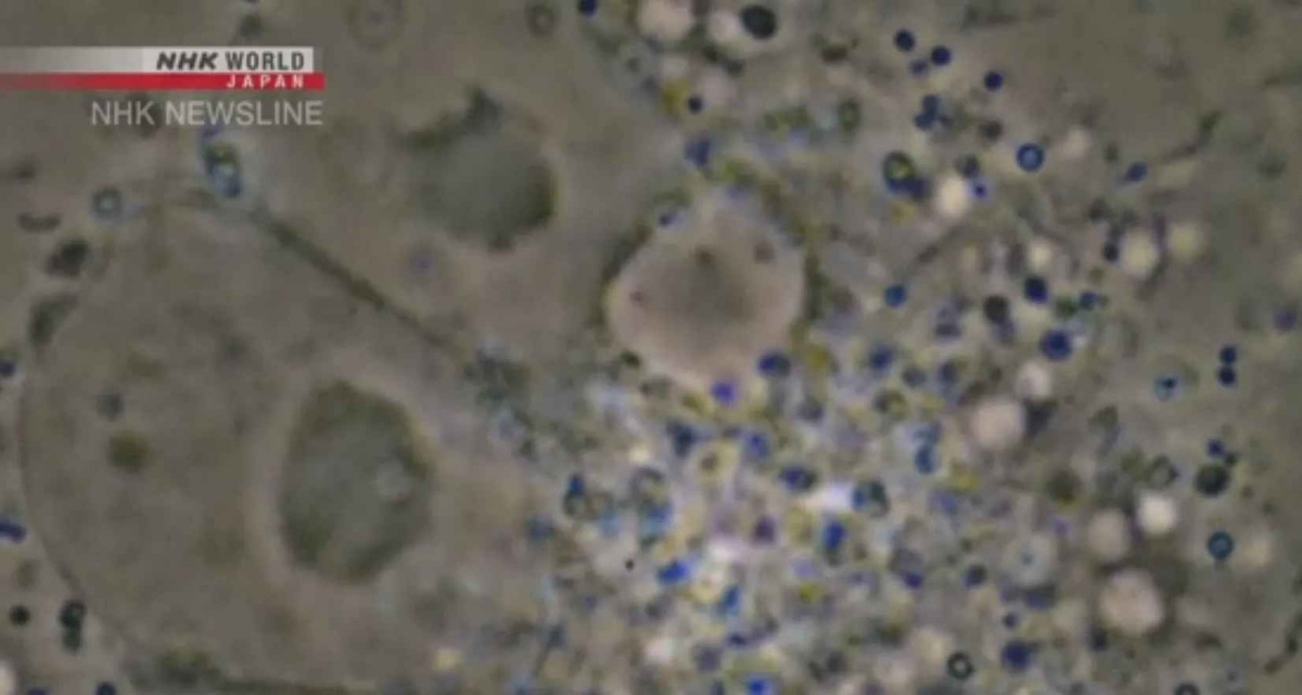 Японские ученые показали, как COVID-19 убивает живые клетки