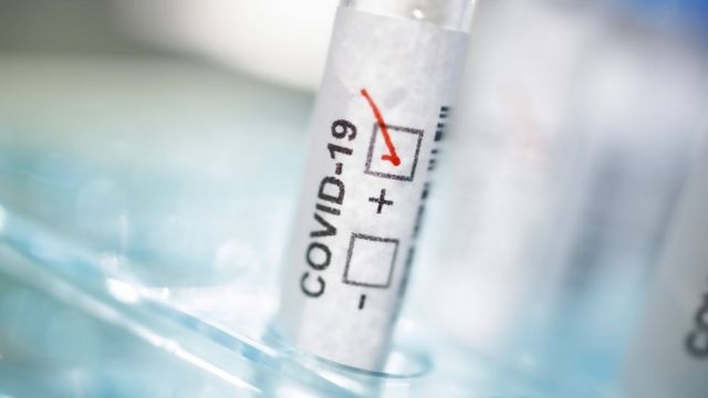 Ученые назвали ранние признаки коронавируса нового типа