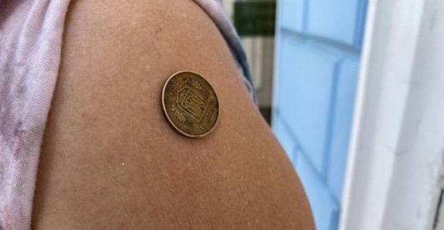 "Последствия" вакцинации: к руке женщины начали примагничиваться монеты
