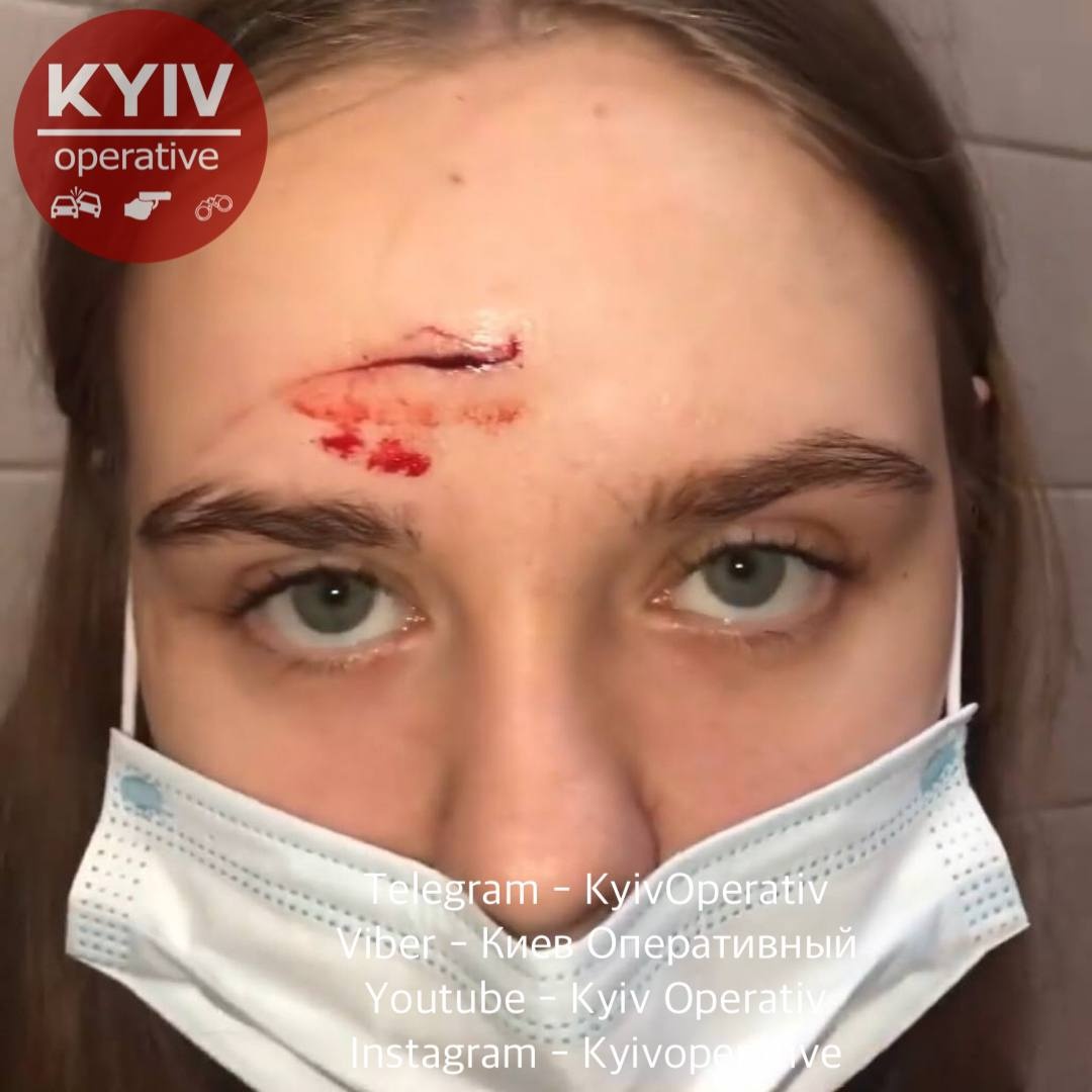 В киевском ТРЦ средь бела дня неадекватная женщина избила зонтиком молодую девушку
