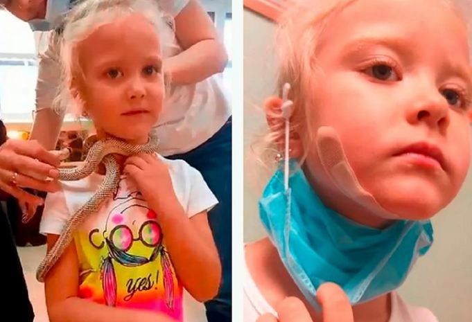 Ребенок бился в агонии: 5-летнюю россиянку едва удалось спасти после укуса ядовитой змеи