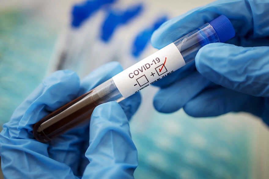 Киев обновил антирекорд по смертности от коронавируса