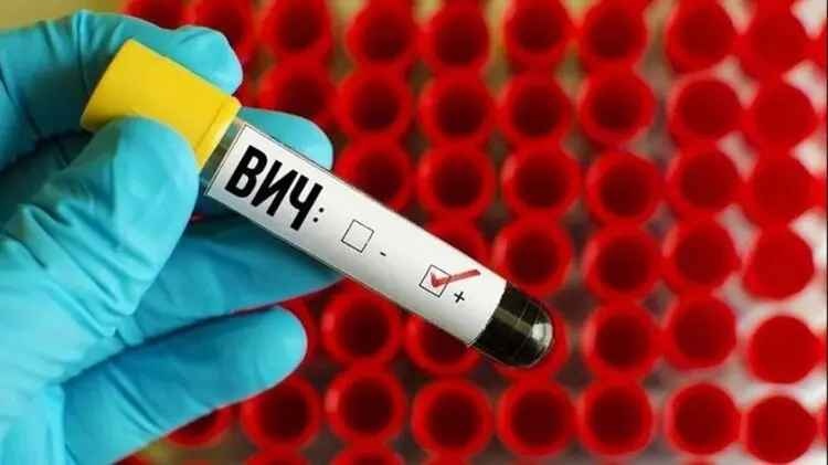 Медики объяснили разницу между понятиями СПИД и ВИЧ