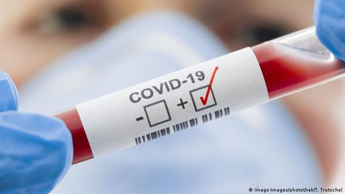 Минздрав изменил правила отслеживания передачи COVID-19