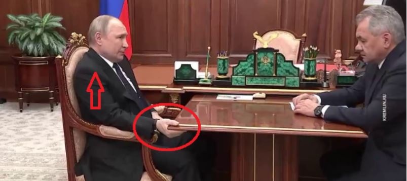Нога, рука и шея: на встрече Путина и Шойгу заметили новые странности