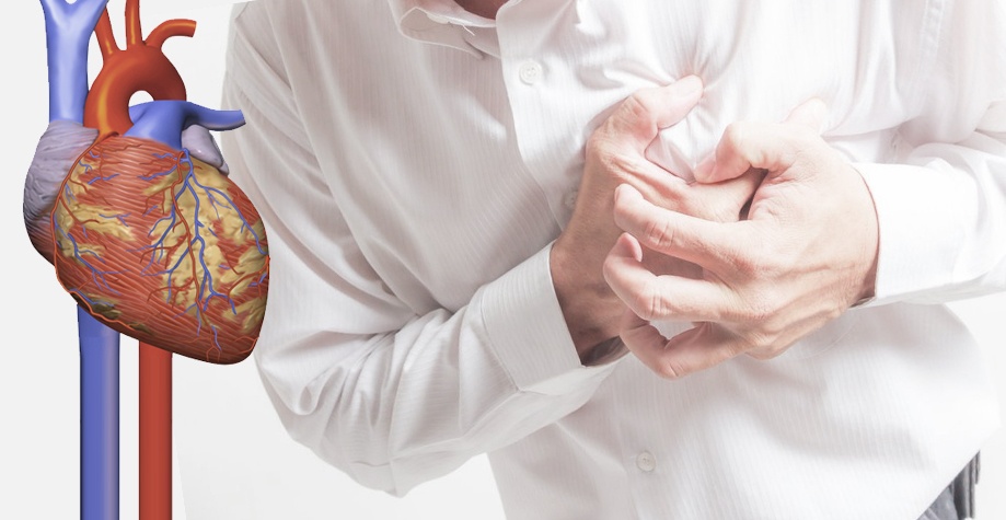 Лікар пояснила, як відрізнити інфаркт від печії та невралгії